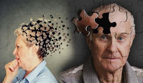 Alzheimer Demans Arasindaki Farklar